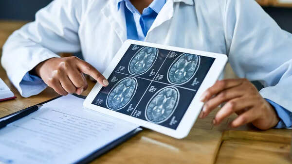 Conceptual image representing the complexities of brain injury and behavior.